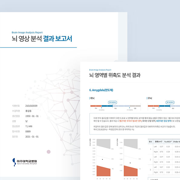 뉴로젠